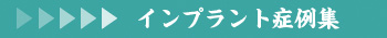 インプラント症例集